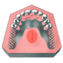 Stellite plaque "U"